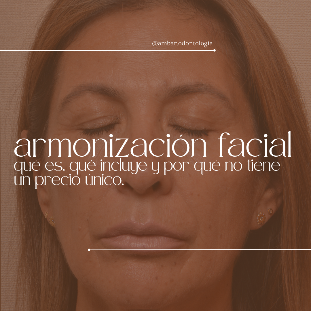 Armonización facial: qué es, qué incluye y por qué no tiene un precio único