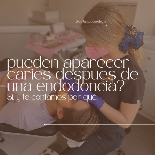 ¿Pueden aparecer caries después de una endodoncia? Sí, y te contamos por qué